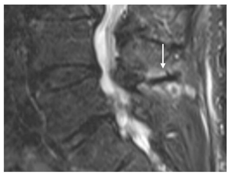 https://cdn.ncbi.nlm.nih.gov/pmc/blobs/bb14/11726990/08d905ad4c71/diseases-12-00302-g001.jpg