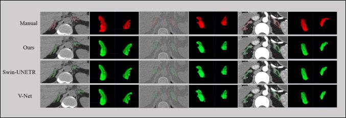 https://cdn.ncbi.nlm.nih.gov/pmc/blobs/bb24/11811328/620115a87176/10278_2024_1158_Fig4_HTML.jpg