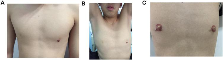 https://cdn.ncbi.nlm.nih.gov/pmc/blobs/bb2b/8055361/63b24a7ffe3b/CCID-14-377-g0002.jpg
