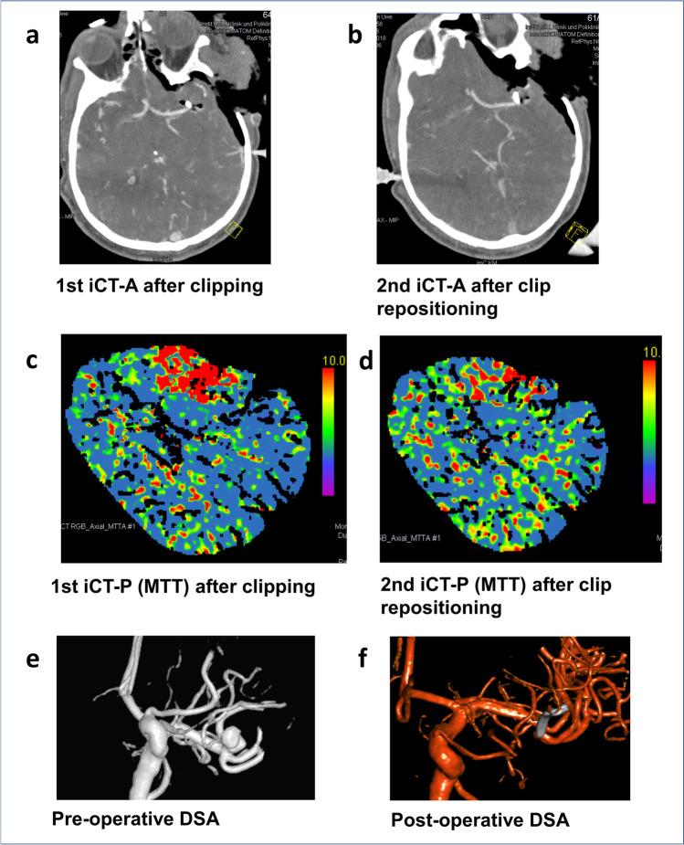 https://cdn.ncbi.nlm.nih.gov/pmc/blobs/bb2b/8599411/116685ecc6c6/701_2021_5022_Fig3_HTML.jpg