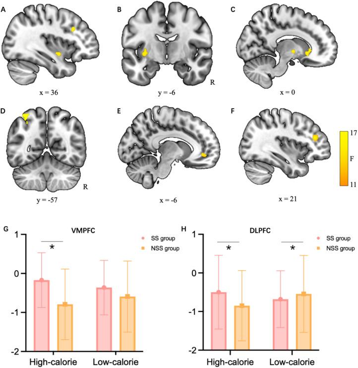 https://cdn.ncbi.nlm.nih.gov/pmc/blobs/bb2d/11783060/693c068f253d/gr1.jpg