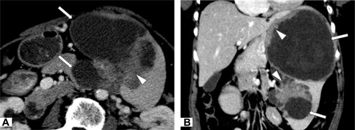 https://cdn.ncbi.nlm.nih.gov/pmc/blobs/bb38/5417741/3078712d89f2/gr1.jpg