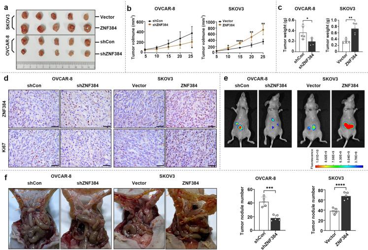 https://cdn.ncbi.nlm.nih.gov/pmc/blobs/bb3d/11576860/e935a5c07484/10565_2024_9938_Fig5_HTML.jpg