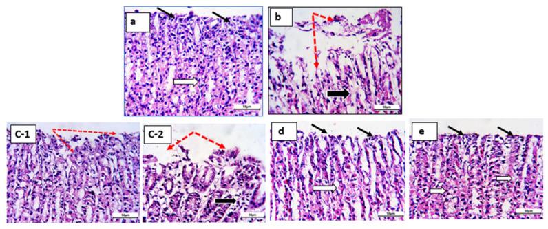 https://cdn.ncbi.nlm.nih.gov/pmc/blobs/bb40/9964971/0ee8c881276d/pharmaceutics-15-00713-g010.jpg
