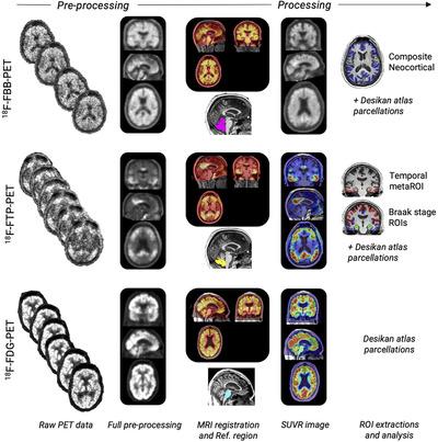 https://cdn.ncbi.nlm.nih.gov/pmc/blobs/bb48/9541332/31f8c9cb3f02/ALZ-17-2043-g003.jpg