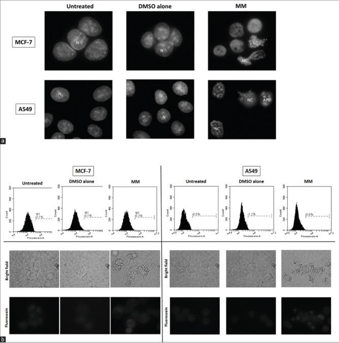 https://cdn.ncbi.nlm.nih.gov/pmc/blobs/bb4a/5669117/28487e150106/PM-13-688-g003.jpg