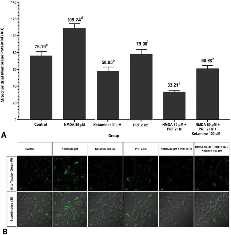https://cdn.ncbi.nlm.nih.gov/pmc/blobs/bb51/10216856/f5e3ed88a445/JPR-16-1697-g0008.jpg