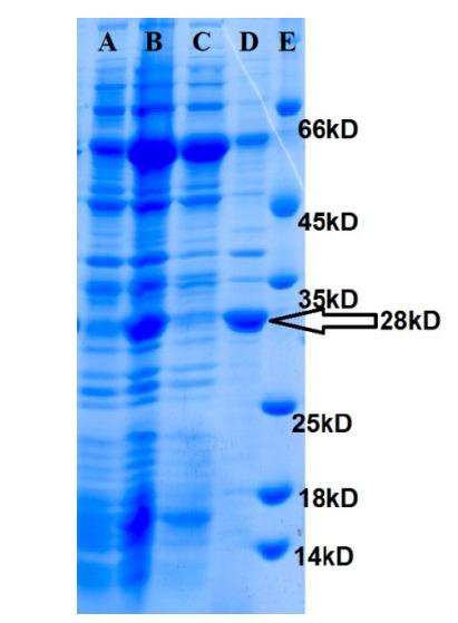 https://cdn.ncbi.nlm.nih.gov/pmc/blobs/bb56/7856399/83865d212a27/IJB-18-e2314-g003.jpg