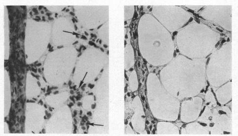 https://cdn.ncbi.nlm.nih.gov/pmc/blobs/bb59/510192/0e45150ba183/brjopthal00413-0003-b.jpg