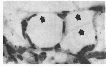 https://cdn.ncbi.nlm.nih.gov/pmc/blobs/bb59/510192/b2c98015fca9/brjopthal00413-0004-a.jpg