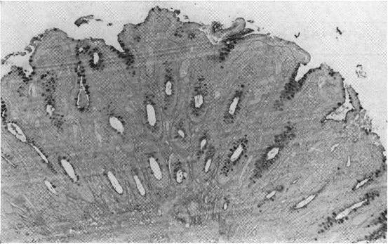 https://cdn.ncbi.nlm.nih.gov/pmc/blobs/bb5d/1411437/1ac5b7799cd7/gut00664-0048-a.jpg