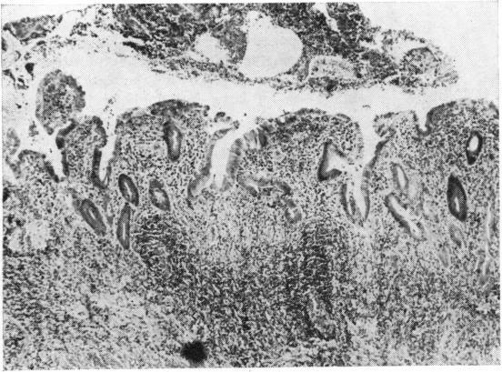 https://cdn.ncbi.nlm.nih.gov/pmc/blobs/bb5d/1411437/f432562f0952/gut00664-0047-a.jpg