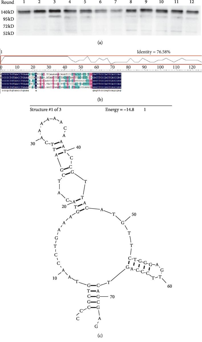 https://cdn.ncbi.nlm.nih.gov/pmc/blobs/bb61/6995496/6d9bd5b3d8a4/CDTP2020-6869856.002.jpg