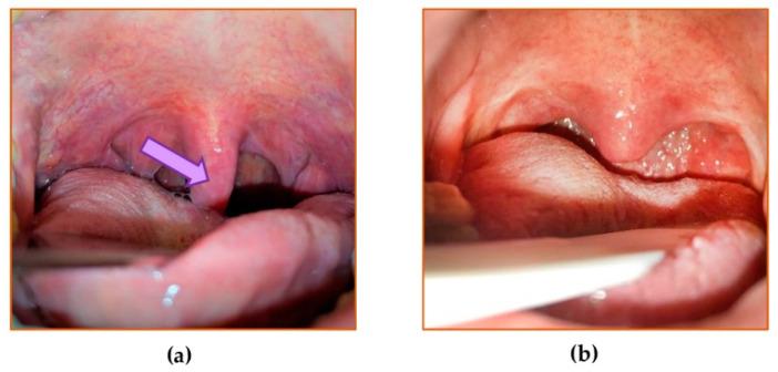 https://cdn.ncbi.nlm.nih.gov/pmc/blobs/bb63/7962821/70f9a2d84e6b/jcm-10-01132-g001.jpg
