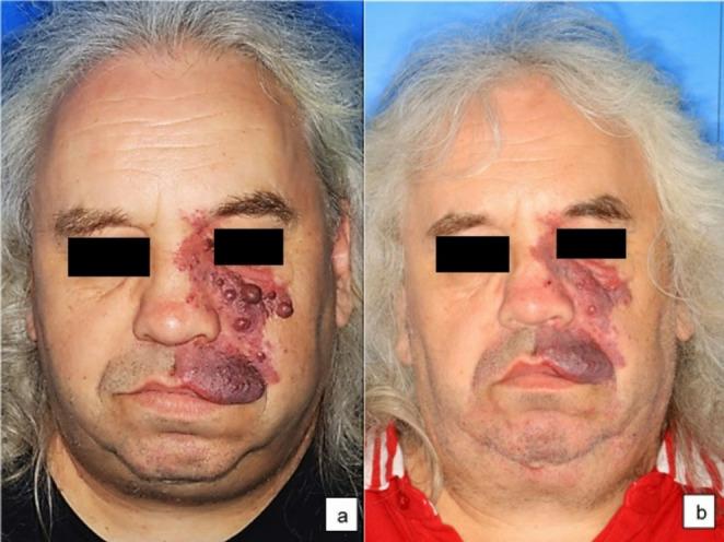 https://cdn.ncbi.nlm.nih.gov/pmc/blobs/bb67/12356726/23a655305feb/10103_2025_4591_Fig1_HTML.jpg