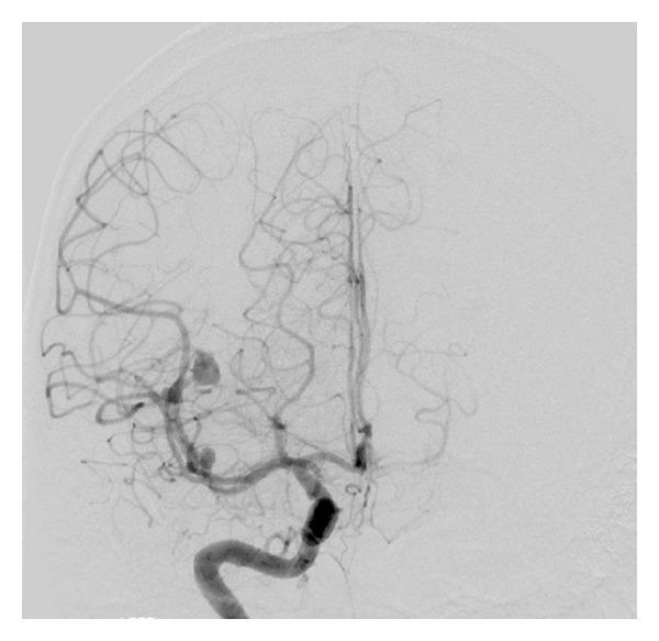 https://cdn.ncbi.nlm.nih.gov/pmc/blobs/bb67/3800601/20147ecdc5a2/CRIM.VASMED2013-797045.003.jpg