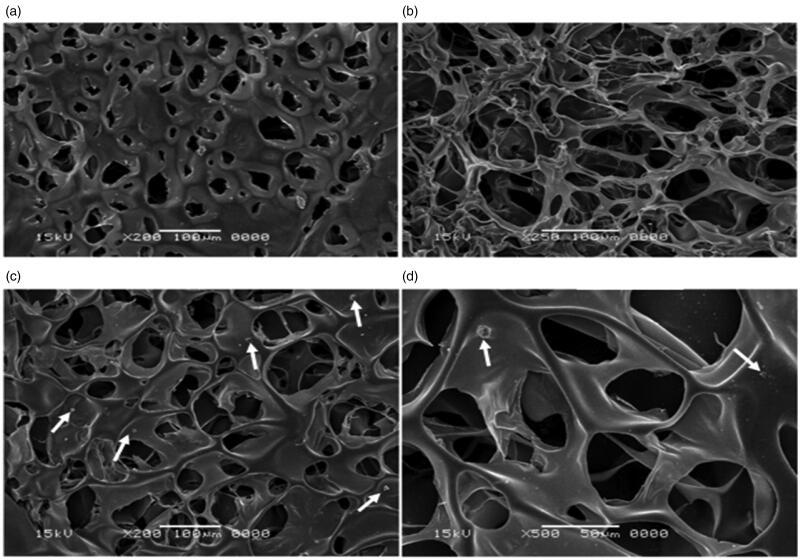 https://cdn.ncbi.nlm.nih.gov/pmc/blobs/bb67/7758044/cff323d0314e/IDRD_A_1858999_F0003_B.jpg
