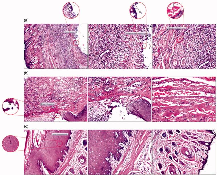 https://cdn.ncbi.nlm.nih.gov/pmc/blobs/bb67/7758044/d5d78add7fbd/IDRD_A_1858999_F0006_C.jpg