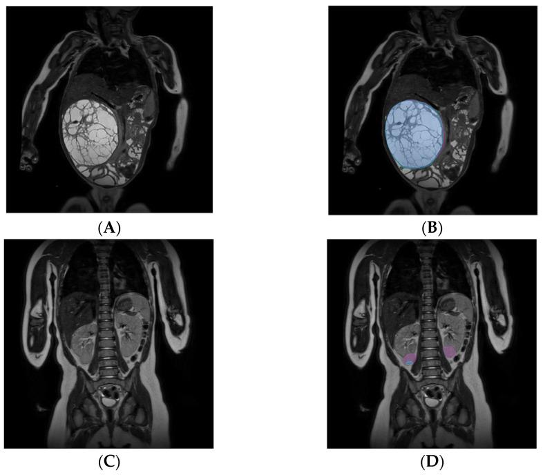 https://cdn.ncbi.nlm.nih.gov/pmc/blobs/bb69/10092966/d314417ae47a/cancers-15-02115-g004.jpg