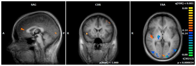 https://cdn.ncbi.nlm.nih.gov/pmc/blobs/bb6a/9775232/93cc91e892b7/brainsci-12-01714-g002.jpg