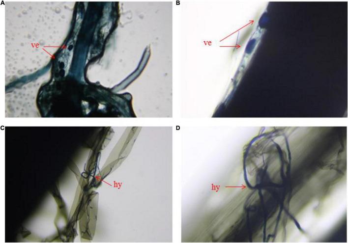 https://cdn.ncbi.nlm.nih.gov/pmc/blobs/bb70/8981305/27b5bda0948e/fmicb-13-814323-g002.jpg