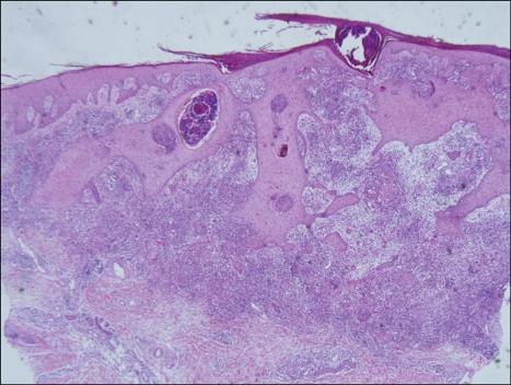 https://cdn.ncbi.nlm.nih.gov/pmc/blobs/bb72/3162270/d783f556eed9/ad-23-369-g006.jpg