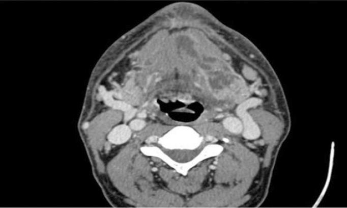 https://cdn.ncbi.nlm.nih.gov/pmc/blobs/bb73/5045698/08a0ff4e3180/jced-8-e469-g001.jpg