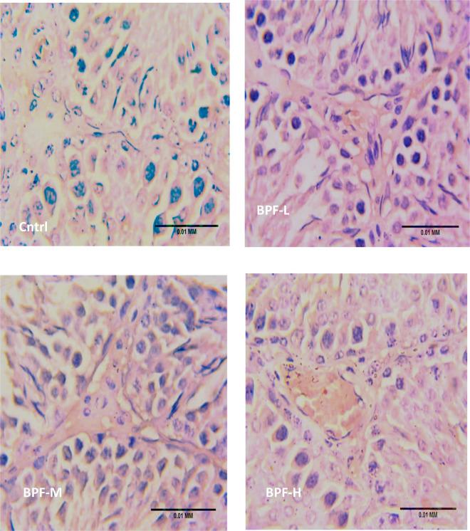 https://cdn.ncbi.nlm.nih.gov/pmc/blobs/bb81/10433915/ec0da6d1d924/frph-05-1204728-g010a.jpg