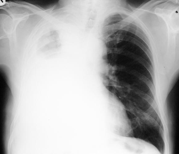 https://cdn.ncbi.nlm.nih.gov/pmc/blobs/bb85/2001143/0365e0429ea8/umj7602-065-f1.jpg