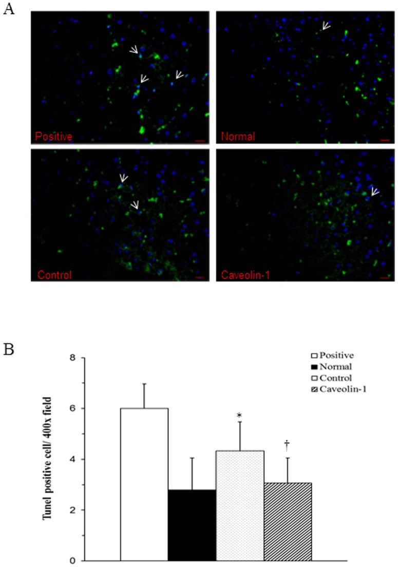 https://cdn.ncbi.nlm.nih.gov/pmc/blobs/bb89/3901645/4fae882dd9fd/pone.0071862.g006.jpg
