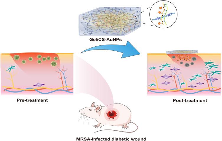 https://cdn.ncbi.nlm.nih.gov/pmc/blobs/bb92/10891276/9b222b40dfc7/IJN-19-1539-g0001.jpg