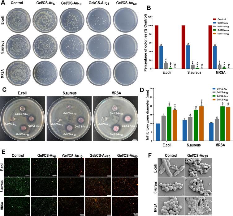 https://cdn.ncbi.nlm.nih.gov/pmc/blobs/bb92/10891276/bad109397f30/IJN-19-1539-g0006.jpg
