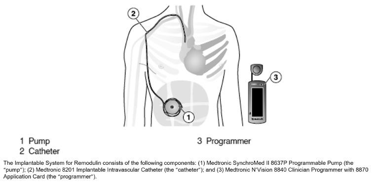 https://cdn.ncbi.nlm.nih.gov/pmc/blobs/bba5/7177997/c710f296f60d/10.1177_2045894020907881-fig1.jpg