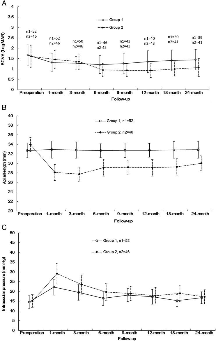 https://cdn.ncbi.nlm.nih.gov/pmc/blobs/bba6/5629954/46c4abf48d56/bjophthalmol-2016-310123f04.jpg