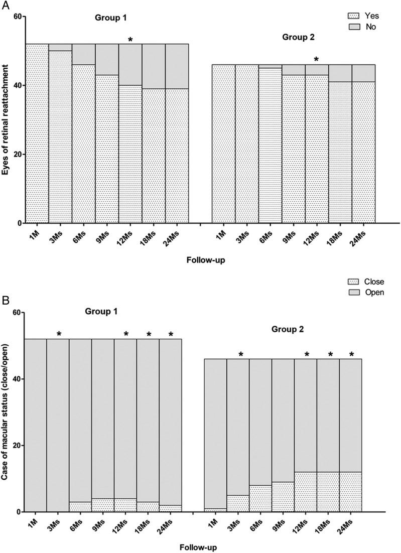 https://cdn.ncbi.nlm.nih.gov/pmc/blobs/bba6/5629954/f2a1178d3ce4/bjophthalmol-2016-310123f03.jpg