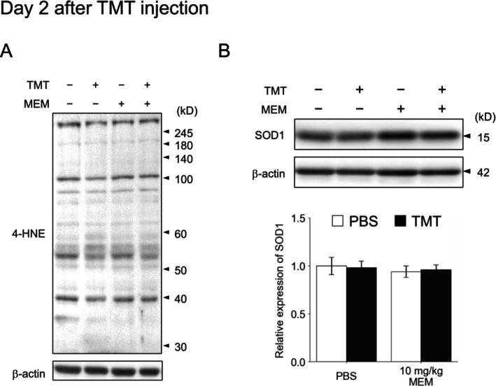 https://cdn.ncbi.nlm.nih.gov/pmc/blobs/bba8/11973579/08fb2b06e0a2/NPR2-45-e70014-g006.jpg