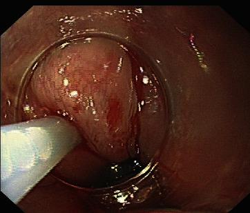 https://cdn.ncbi.nlm.nih.gov/pmc/blobs/bba8/8024074/eaac764e7610/CJGH2021-8856048.001.jpg
