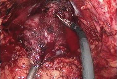 https://cdn.ncbi.nlm.nih.gov/pmc/blobs/bbb1/4374145/a898a84a1612/gr1.jpg