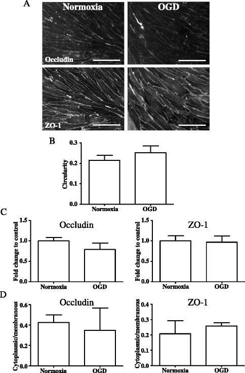 https://cdn.ncbi.nlm.nih.gov/pmc/blobs/bbb2/4736307/65eb24dc916e/12974_2016_495_Fig1_HTML.jpg