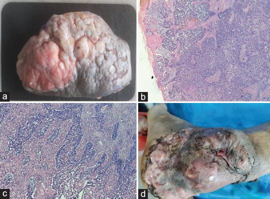 https://cdn.ncbi.nlm.nih.gov/pmc/blobs/bbb4/11412559/f0bb567a7feb/IJABMR-14-202-g002.jpg