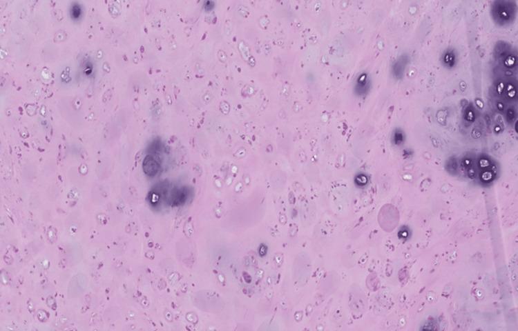 https://cdn.ncbi.nlm.nih.gov/pmc/blobs/bbb5/10219638/cc18bd422756/cureus-0015-00000038827-i03.jpg