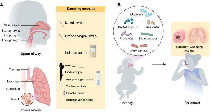 https://cdn.ncbi.nlm.nih.gov/pmc/blobs/bbb6/11827842/0d7a79d72870/jci-135-184316-g071.jpg