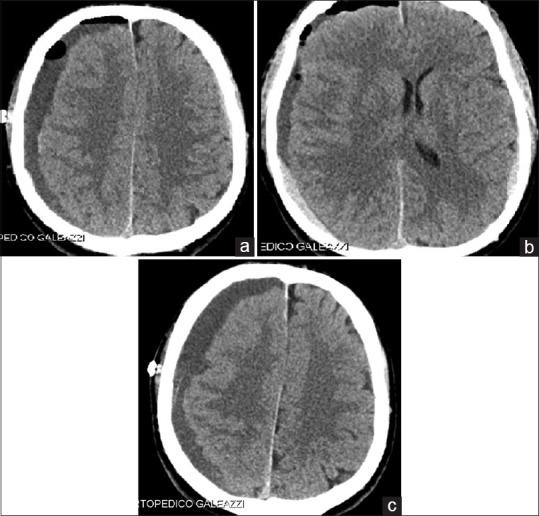 https://cdn.ncbi.nlm.nih.gov/pmc/blobs/bbb8/6417290/ce127324d087/AJNS-14-249-g004.jpg