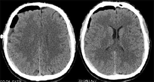 https://cdn.ncbi.nlm.nih.gov/pmc/blobs/bbb8/6417290/e16af976a9f3/AJNS-14-249-g003.jpg