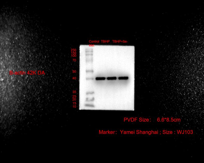 https://cdn.ncbi.nlm.nih.gov/pmc/blobs/bbc4/10594567/361a1d792bf5/mmcfigs20.jpg