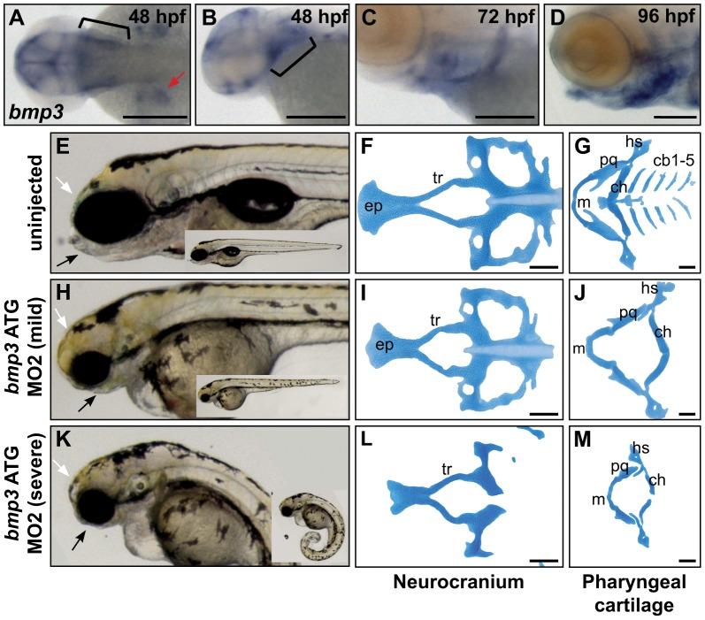 https://cdn.ncbi.nlm.nih.gov/pmc/blobs/bbc8/3410846/bd661ebd827f/pgen.1002849.g004.jpg