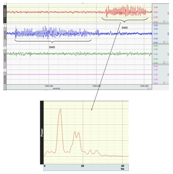 https://cdn.ncbi.nlm.nih.gov/pmc/blobs/bbce/8946037/e73f7e998c56/brainsci-12-00361-g004.jpg