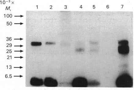 https://cdn.ncbi.nlm.nih.gov/pmc/blobs/bbcf/1133521/e59ee325d3bd/biochemj00196-0314-d.jpg