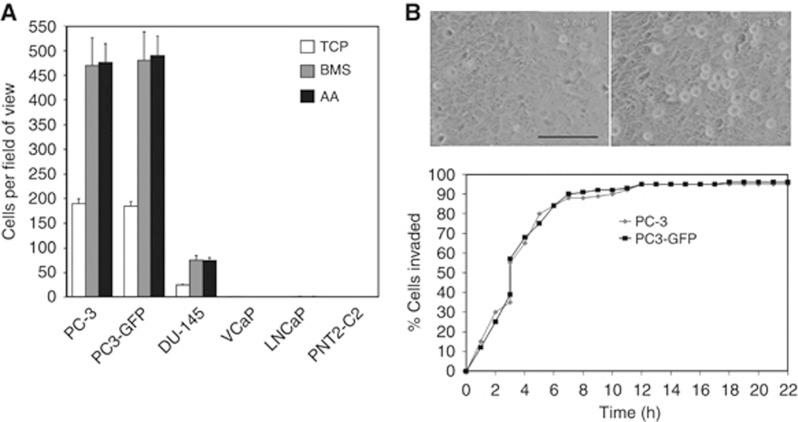 https://cdn.ncbi.nlm.nih.gov/pmc/blobs/bbd2/3992515/8555b2e69d8c/bjc201499f1.jpg