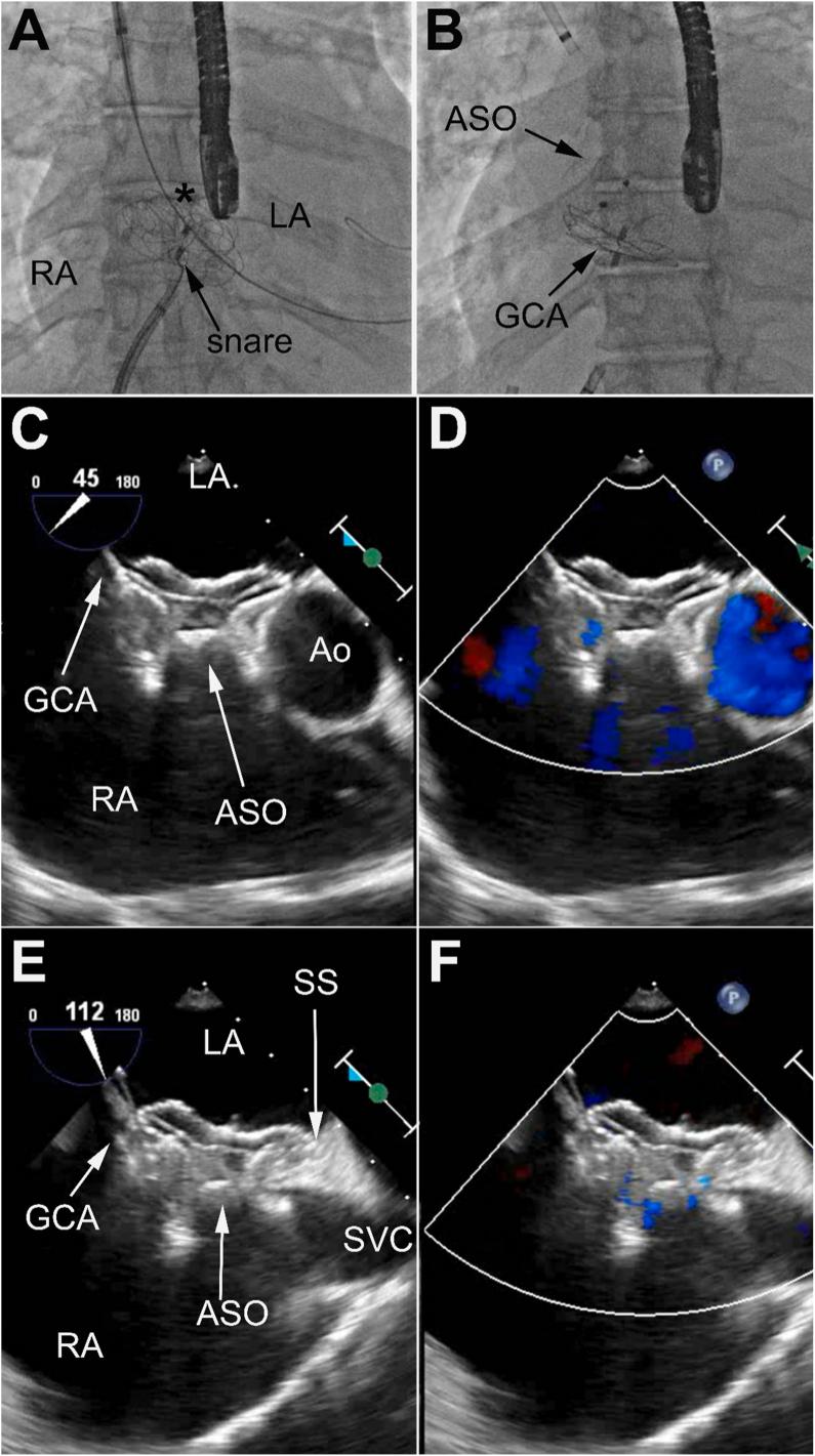 https://cdn.ncbi.nlm.nih.gov/pmc/blobs/bbd4/11658217/feddf9965b07/gr4.jpg